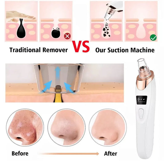5 in 1 Blackhead Remover Machine Rechargeable | Face Vacuum Derma Suction With 5 Heads