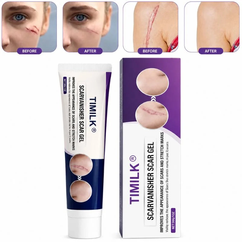 TIMILK Scarvanisher Scar Gel 30g tube