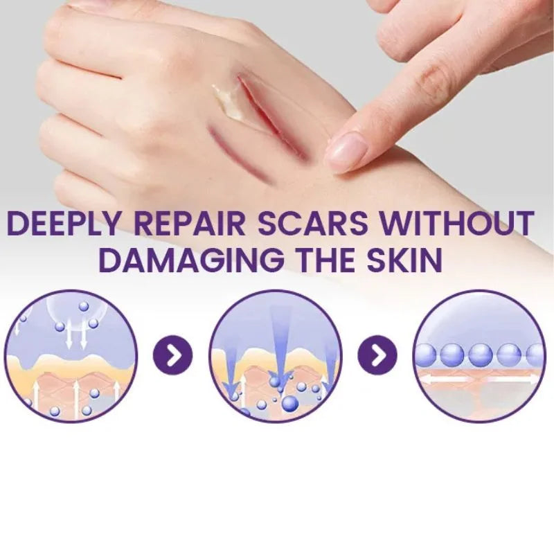 TIMILK scar gel applied to skin