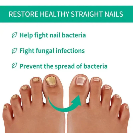 Fast Nail Fungus Treatment Serum | Nail Repair Essence for Fingernails & Toenails | Natural Nail Care Formula