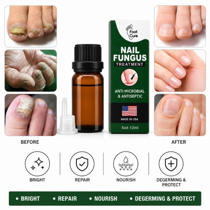 Fast Nail Fungus Treatment Serum 10ml bottle